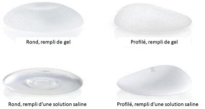 Implant mammaire